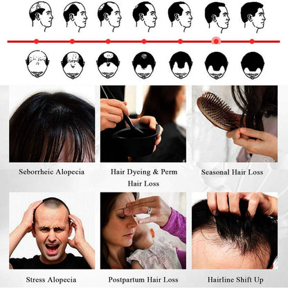 Ellohe Anti Hair Loss Hair Growth Fluid 60 ML Pack of 1